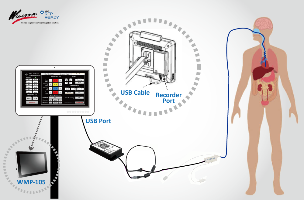 Application of WMP-K /S series Medical Edge AI Panel PCs